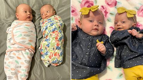 Μικροσκοπικό διδυμάκι νίκησε τον θάνατο 2 φορές και δυναμώνει καθημερινά!