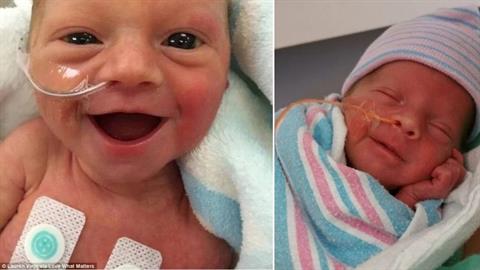 Προωράκι λάμπει από χαρά 5 μέρες μετά τη γέννησή του!