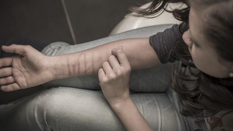 Γιατί ένα παιδί αυτοτραυματίζεται και πώς να το βοηθήσουμε