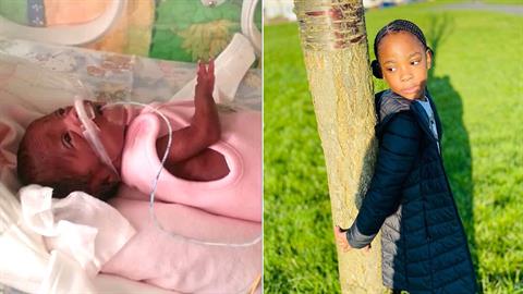 Πρόωρο νίκησε όλα τα προβλήματα υγείας και σήμερα είναι ένα υγιέστατο κοριτσάκι!