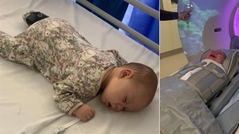 Μωράκι 6 μηνών έπεσε από την αλλαξιέρα και έπαθε κάταγμα στο κρανίο! 
