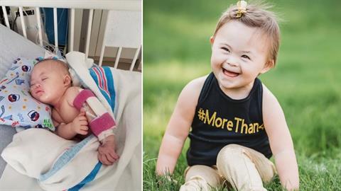 «Η κόρη μας νίκησε τον καρκίνο 2 φορές και δεν σταμάτησε ποτέ να χαμογελά»