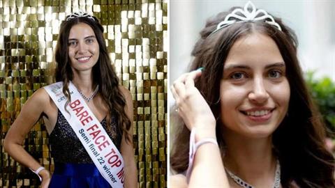 Φιναλίστ στα καλλιστεία διαγωνίστηκε χωρίς ίχνος μακιγιάζ και... εντυπωσίασε!