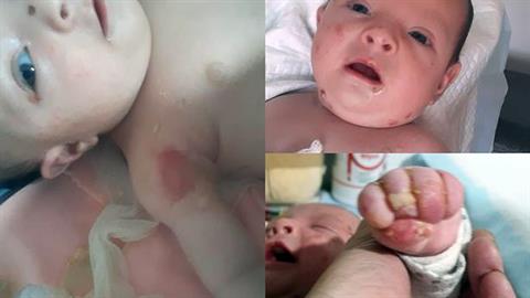 Η σπάνια πάθηση αυτού του μωρού εμποδίζει τους γονείς του να το πάρουν αγκαλιά!