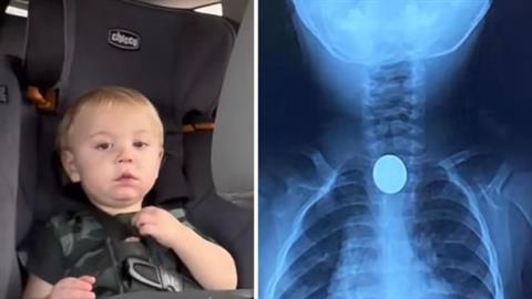 Νηπιάκι κατάπιε ένα κέρμα και κινδύνευσε να χάσει τη ζωή του!