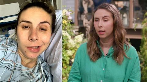 Σπάνιo σύμπτωμα της εγκυμοσύνης τής προκάλεσε παράλυση στο πρόσωπο!