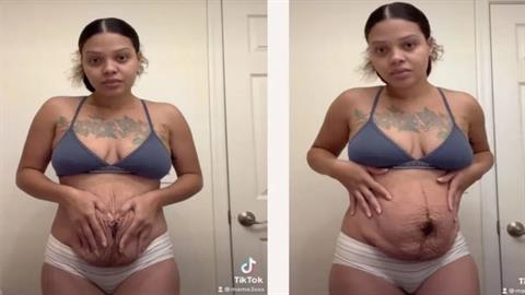 «Έτσι είναι το σώμα μου μετά τον τοκετό και δεν ντρέπομαι καθόλου!»