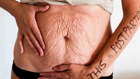 «Φοβόμουν για όσα θα πάθαινε το σώμα μου στην εγκυμοσύνη και τη γέννα»