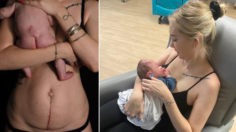 «Το αγοράκι μας ζει χάρη στην επέμβαση που έκανε πριν ακόμα γεννηθεί!»