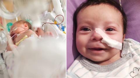 Ο 3 μηνών Νεκτάριος έδωσε μια δύσκολη μάχη για τη ζωή του και την κέρδισε!