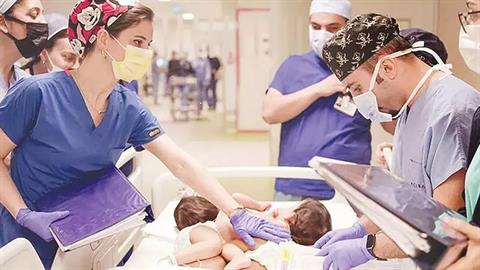 Σιαμαία που ήταν ενωμένα στο στέρνο διαχωρίστηκαν με επιτυχία!