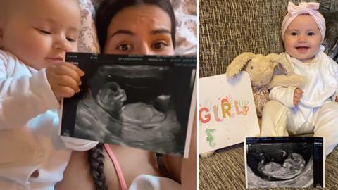 Έμεινε έγκυος στο 2ο όταν το 1ο ήταν 6 εβδομάδων: «θέλω να μεγαλώσουν σαν διδυμάκια»