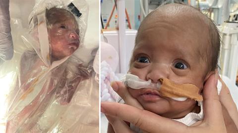 «Μόνο εγώ πίστευα ότι το μικροσκοπικό προωράκι μου θα ζήσει και είχα δίκιο!»