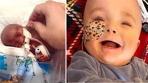 Μωράκι που του έδιναν 1 μέρα ζωής, έσβησε το 1ο του κεράκι