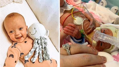 Προωράκι θα γιορτάσει τα Χριστούγεννα σπίτι του μετά από σκληρή μάχη για τη ζωή του