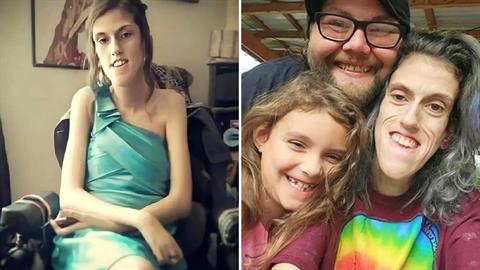 «Με αποκαλούν τέρας αλλά δεν με νοιάζει - στα μάτια της κόρης μου είμαι όμορφη»