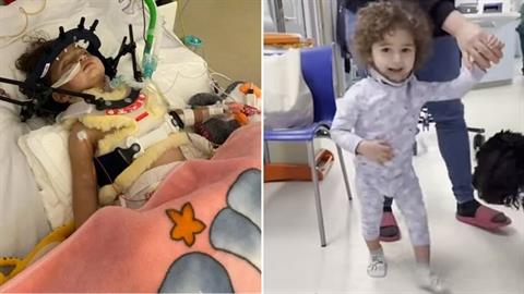 Νηπιάκι περπάτησε ξανά μετά από τροχαίο που διέλυσε τη σπονδυλική του στήλη