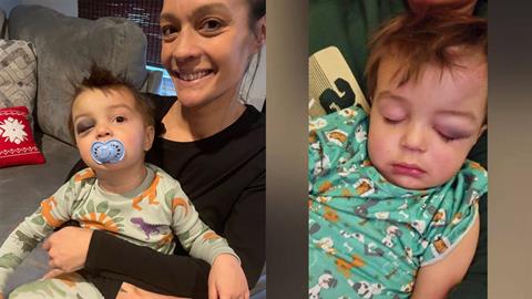 2χρονο αγοράκι έπεσε από τον 2ο όροφο και επέζησε! 