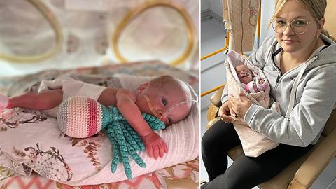 Προωράκι 390 γραμμαρίων πάλεψε γενναία για τη ζωή του και τα κατάφερε!