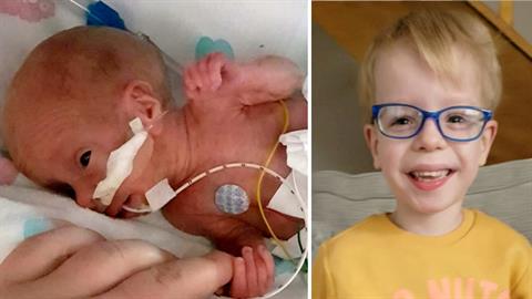 Προωράκι με 10% πιθανότητες να ζήσει έκλεισε τα 4 και είναι μια μικρή ιδιοφυΐα!