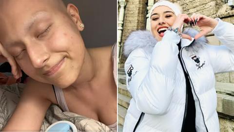 «Νίκησα τον καρκίνο 2 φορές - μου άφησε σημάδια αλλά ζω και είμαι ευγνώμων» 