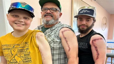 Μπαμπάς και αδερφός έκαναν τατουάζ την ουλή του μικρού γιου της οικογένειας που έχει καρκίνο