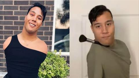 Τον εγκατέλειψαν μωρό επειδή γεννήθηκε χωρίς άκρα - σήμερα διαπρέπει ως makeup artist