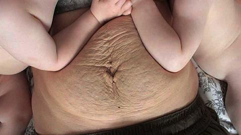 «Όταν νιώσεις ότι δεν είσαι καλή μαμά, χάιδεψε τις ραγάδες στην κοιλιά σου...»