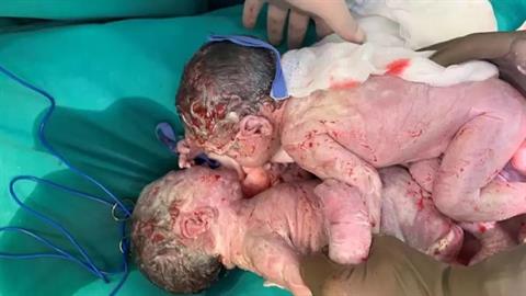 36χρονη από τη Θεσσαλονίκη νίκησε τον καρκίνο του τραχήλου της μήτρας και απέκτησε διδυμάκια!