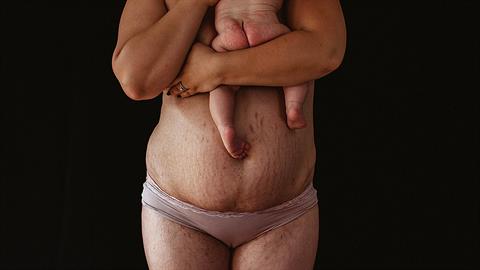 «Το σώμα μου έγινε το σπίτι του μωρού μου για 9 μήνες και αγαπώ όλες τις αλλαγές του»