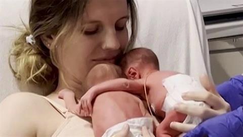 Διδυμάκια που χωρίστηκαν στη ΜΕΝΝ συναντιούνται ξανά και αγκαλιάζονται!