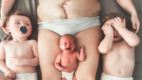 «Αν οι ουλές μας είχαν φωνή, δεν θα μιλούσαν για τον πόνο αλλά για το θαύμα της ζωής»