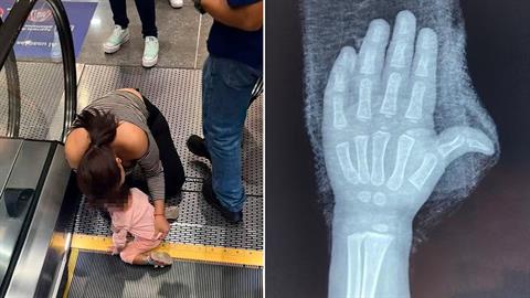 Νηπιάκι παραλίγο να χάσει τα δάχτυλά του σε κυλιόμενες σκάλες!