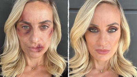 «Μήπως έχεις υπάρξει κι εσύ θύμα;»: η Ελεονώρα Μελέτη μιλά για την κακοποίηση