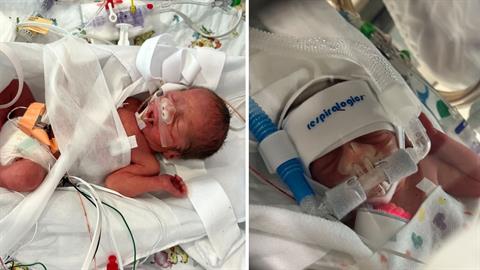 Έγκυος με ελάχιστες πιθανότητες να τα καταφέρει στον τοκετό, επέζησε!