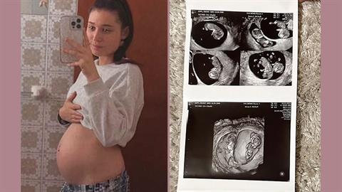 Παρακαλούσε για ένα παιδάκι και τελικά έμεινε έγκυος σε...4δυμα!