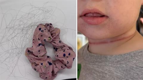 Μωρό παραλίγο να πεθάνει από ασφυξία - το... στραγγάλισαν τα μαλλιά της μαμάς του! 