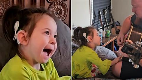 Kοριτσάκι που γεννήθηκε κωφό ακούει πρώτη φορά μουσική με τη βοήθεια εμφυτευμάτων