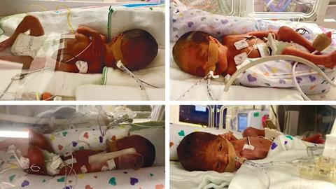 Μαμά 5 παιδιών έμεινε έγκυος ξανά και απέκτησε...4δυμα!