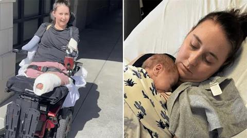 Έπαθε στρεπτόκοκκο στην εγκυμοσύνη και έχασε όλα της τα άκρα!