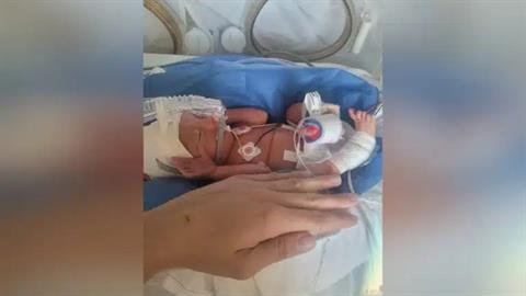 Μαμά ενός πρόωρου μωρού: όταν δεν ξέρεις αν το μωράκι σου θα ζήσει η θα πεθάνει…