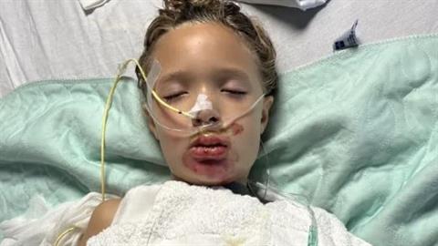 7χρονη μπήκε σε τεχνητό κώμα μετά από επικίνδυνο challenge του TikTok