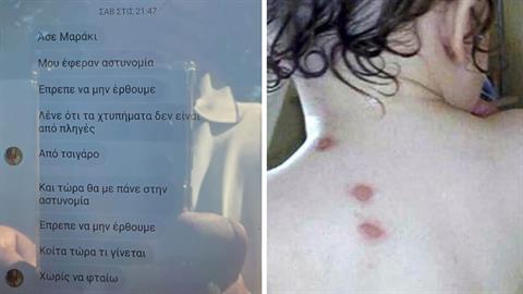 «Δεν έπρεπε να έρθουμε, είδαν τις πληγές»: τα μηνύματα της 32χρονης που έκαιγε με τσιγάρα τα παιδιά της