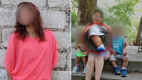 Λάρισα: «με καίνε και με ξύνουν» έλεγε το αγοράκι της 32χρονης για τις πληγές του