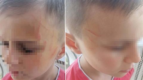 Αγρίνιο: μαθητές νηπιαγωγείου ξυλοκόπησαν άγρια 5χρονο συμμαθητή τους!