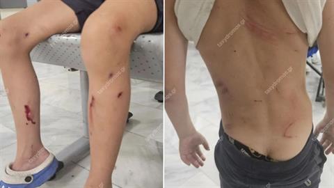 Βόλος: αδέσποτα σκυλιά επιτέθηκαν σε 7χρονο - παραλίγο να το κατασπαράξουν