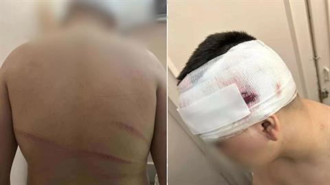 Άγριος ξυλοδαρμός 13χρονου: για απόπειρα ανθρωποκτονίας κατηγορείται ο νεαρός που τον χτύπησε