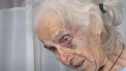 Αιτωλοακαρνανία: ληστές ξυλοκόπησαν άγρια 85χρονη για €100