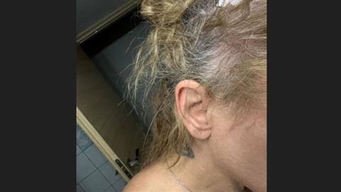 Νταής επιτέθηκε σε γυναίκα οδηγό  επειδή «πήγαινε αργά» - της ξερίζωσε τα μαλλιά!