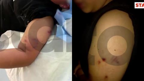 Πέραμα: σκύλος επιτέθηκε σε 12χρονο μαθητή, ακριβώς έξω από το σχολείο του!